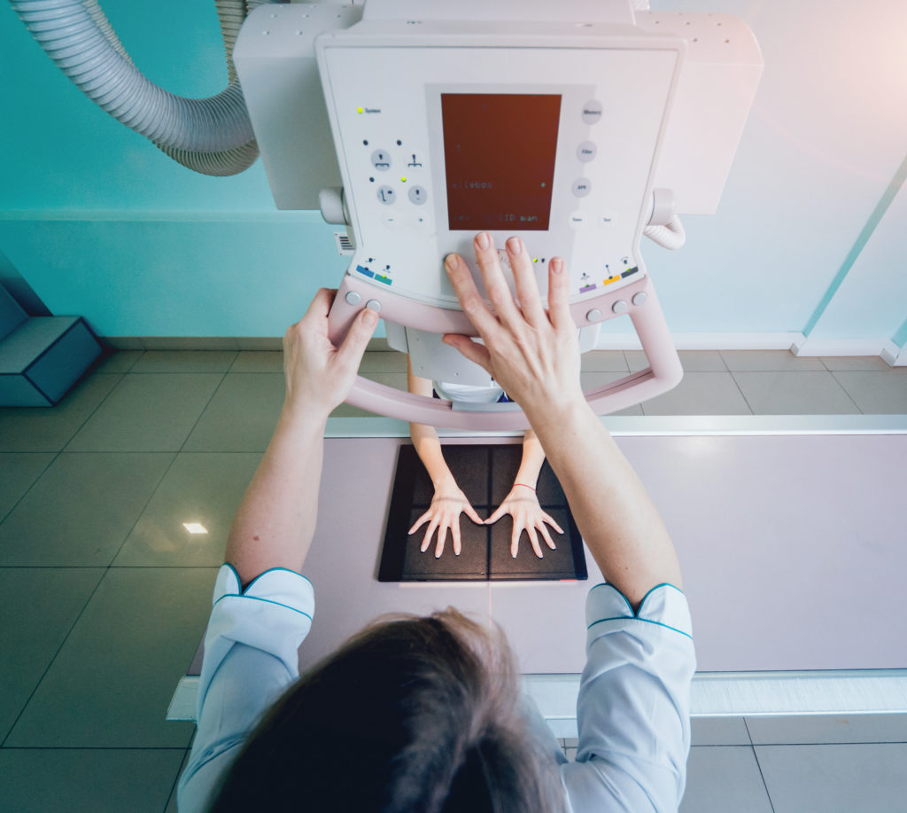 femme en train de passer une radio des membres supérieurs